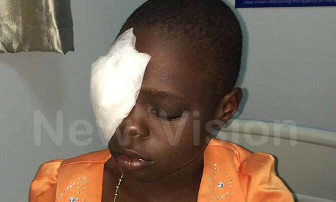 Nine-year-old Serere girl could go blind Nine-year-old Serere girl could go blind