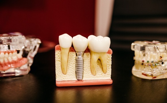 MBK, Unison Korea pursue dental implant buyout