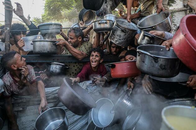 Mideast in Pictures: Stories of hunger in Gaza