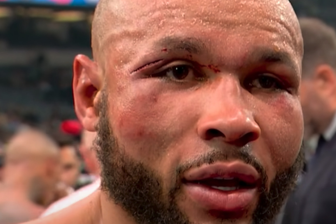 Chris Eubank Jr issues one-word statement from hospital bed after Conor Benn win - The Mirror