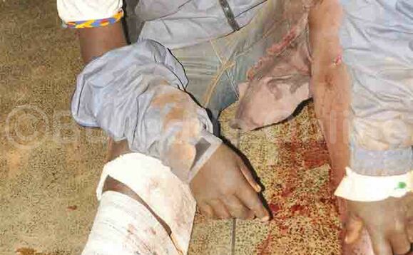 Ivan Boogere mu ddwaaliro e Mulago gye baamututte okufuna obujjanjabi. Ivan Boogere mu ddwaaliro e Mulago gye baamututte okufuna obujjanjabi.