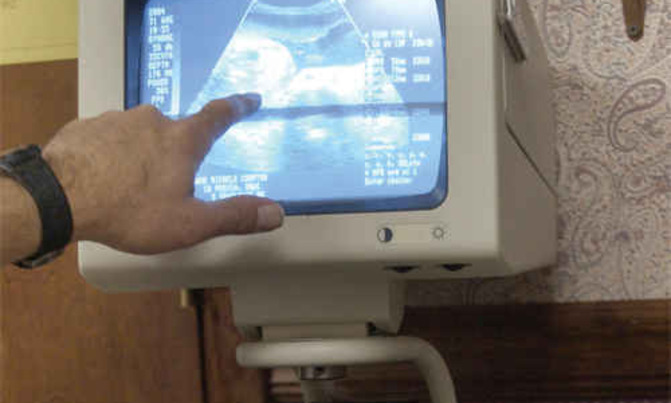 Antenatal: Regular check-up could save your life, your baby Antenatal: Regular check-up could save your life, your baby