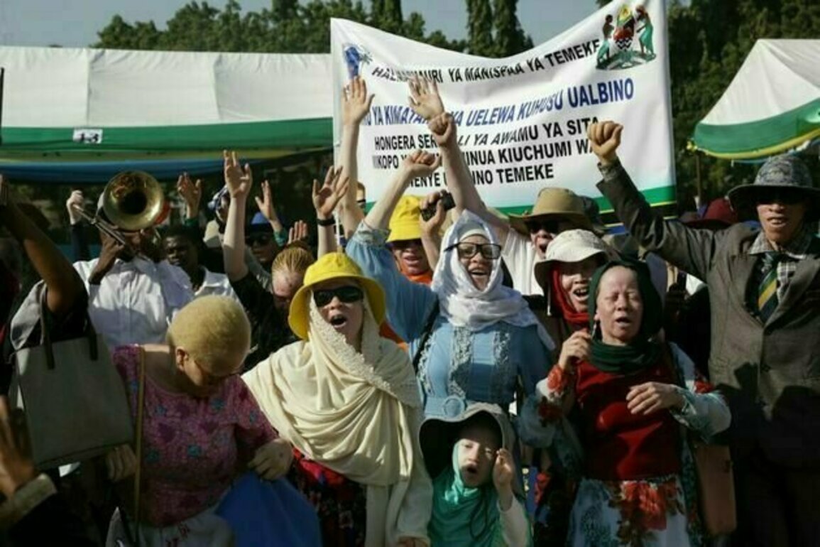 Attacks on people with albinism in Tanzania: African court holds government responsible - why it matters