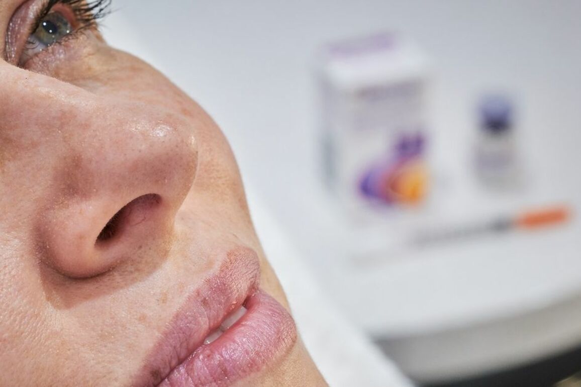 Botox isn't just cosmetic; it's vastly improved my chronic condition - Sheena McStravick