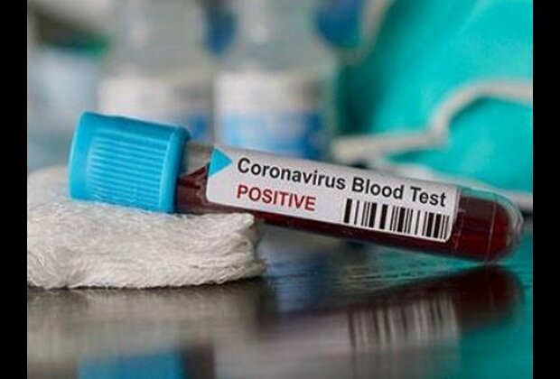 91 people test positive for COVID-19 in Indore