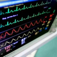 Doctor shortages have hobbled health care for decades - and the trend could be worsening
