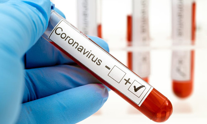 Uganda's COVID-19 cases soar to 971 Uganda's COVID-19 cases soar to 971