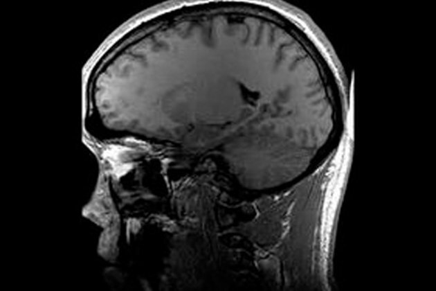 Here's how brain activity evolves fear into anxiety