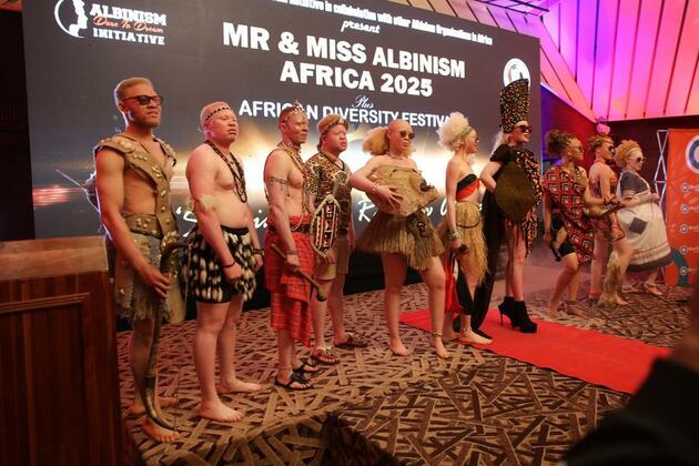 (Hello Africa) African models inspire people with albinism to defy prejudice