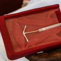 Birth control in Africa: study tracks the use of long-acting contraception in 26 countries