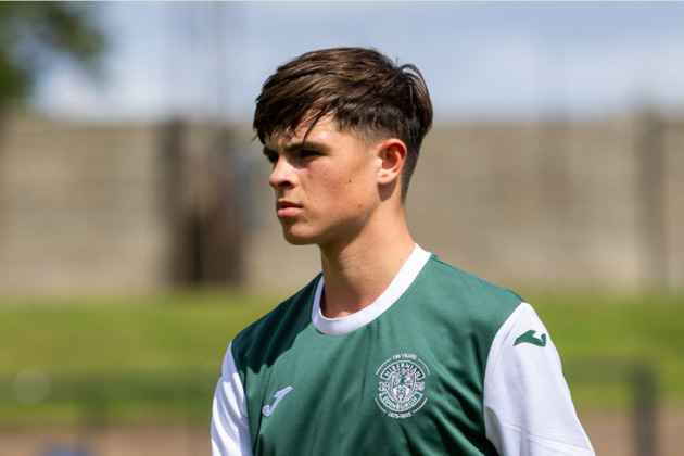 Hibernian FC - Dev Squad To Face Penicuik In Pre-Season Test
