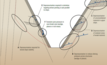 Figure 1: Potential modes of pit-slope instability