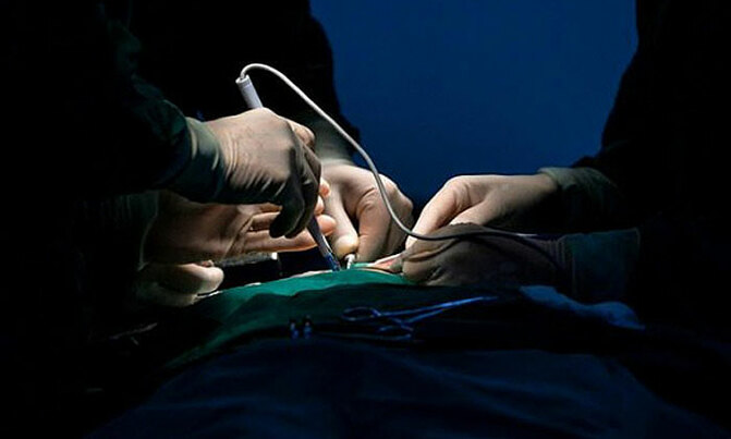 World's first penis, scrotum transplant done World's first penis, scrotum transplant done