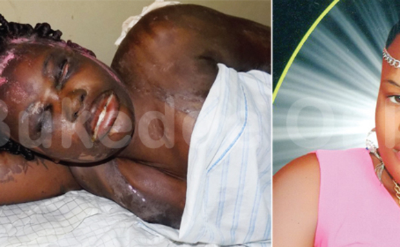 Aisha ng'abwabadde afaanana ng'atannayirwa Acid Aisha ng'abwabadde afaanana ng'atannayirwa Acid
