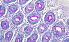 Mucap et al. in €10m Promethera series-C extension