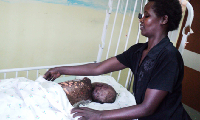 Boy battles for life after reacting to anti-malarials Boy battles for life after reacting to anti-malarials
