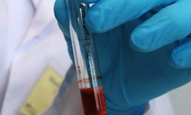 Simple blood test may reveal your body's inner clock Simple blood test may reveal your body's inner clock
