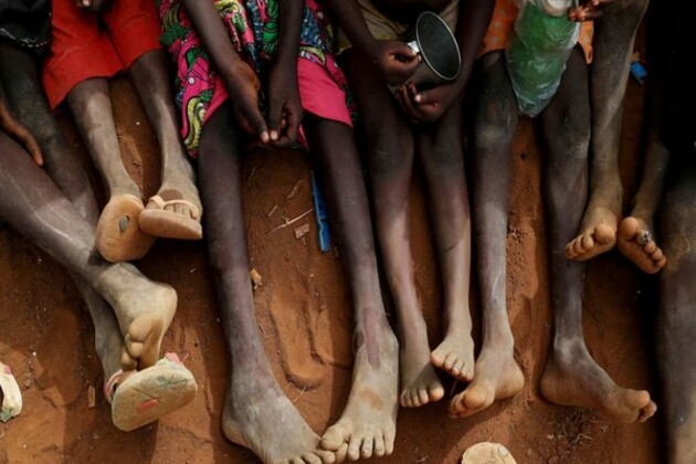 Over 3k Palestinian children admitted for acute malnutrition, UN report states