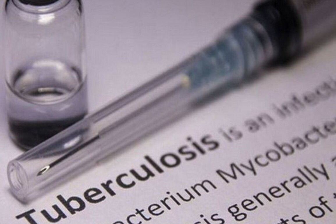 TB incidence in India drops by 21% from 237 per lakh population in 2015 to 187 per lakh population in 2024: Report
