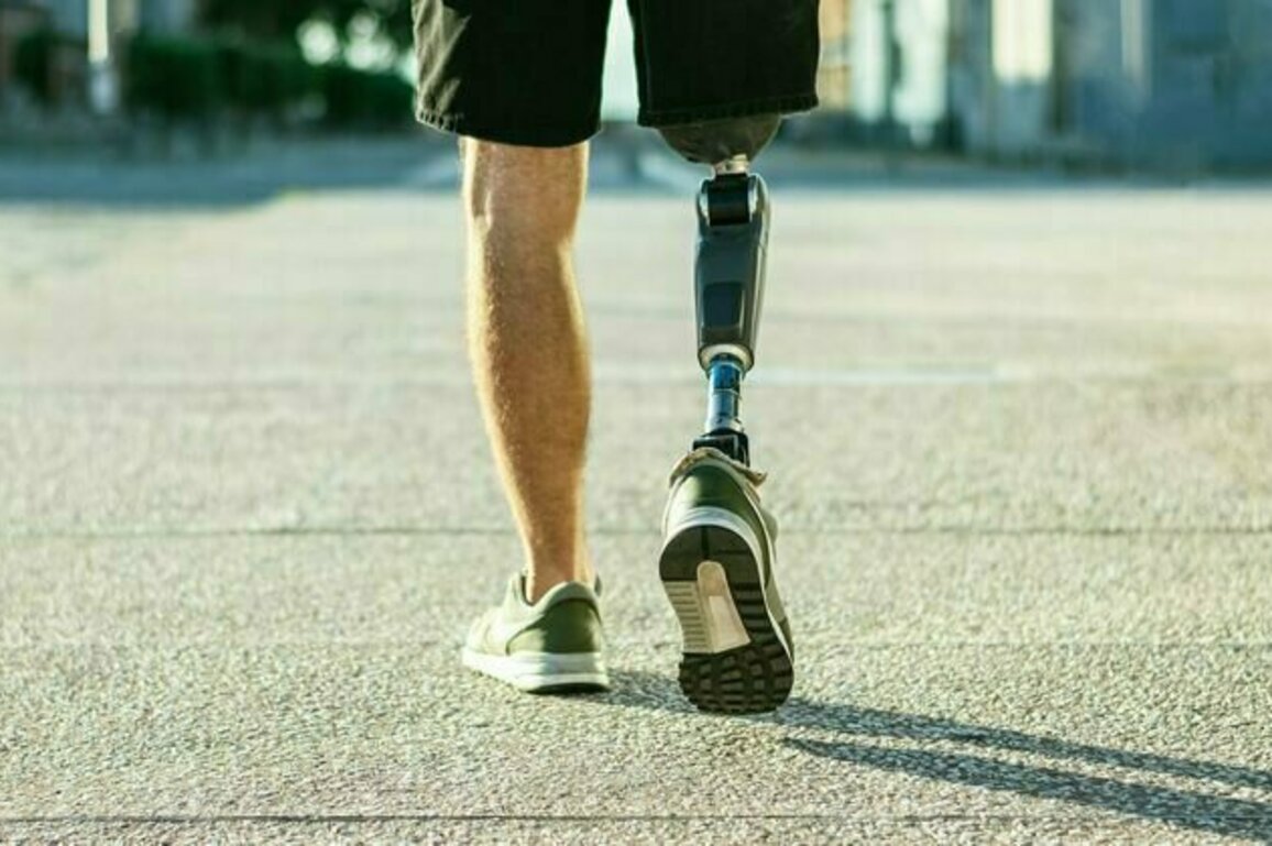 Scientists have been wrong about phantom limbs for decades - new study