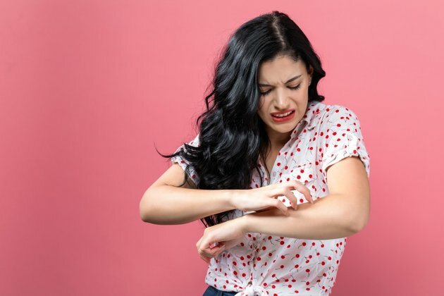 What are hives, the common skin condition that gives you itchy, red bumps?