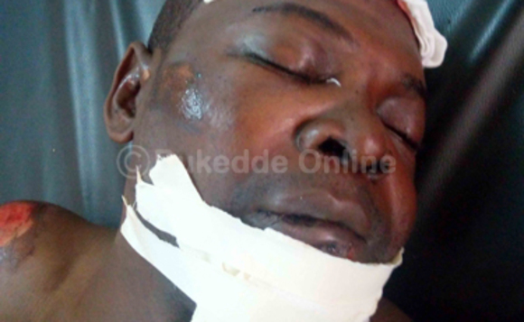 Ono tasobola kwogera, naye nga y'omu ku balwadde abakyalemedde mu ddwaaliro e Mulago. Abantu be tebamanyiddwa. Ono tasobola kwogera, naye nga y'omu ku balwadde abakyalemedde mu ddwaaliro e Mulago. Abantu be tebamanyiddwa.