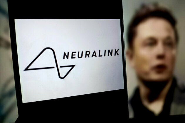Neuralink receives Canadian approval for brain chip implant trials