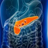 Promising US drug offers hope for pancreatic cancer patients