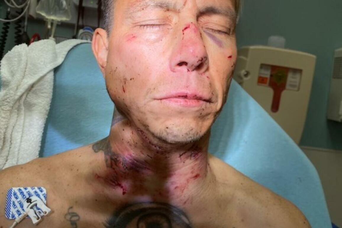 California man whose throat was torn by police dog awarded $1.6 million