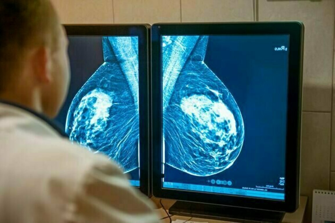 Australian women are wary of AI being used in breast cancer screening - new research