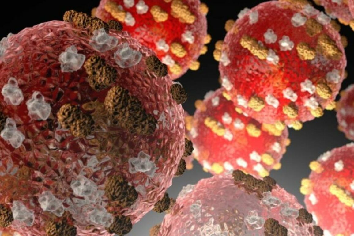Second case of measles confirmed in Hawaii