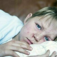 New measles cases in Queensland show 'herd immunity' is more important than ever