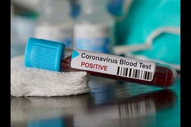 21-year-old tests positive for COVID-19 in Jhunjhunu