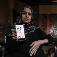 MIDEAST-GAZA-AL-NUSEIRAT REFUGEE CAMP-PATIENT