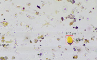 Can agri tech cut fungicide costs without hitting yield?