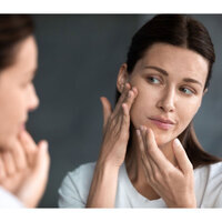 Why Traditional Acne Treatments Fail Women with PCOS