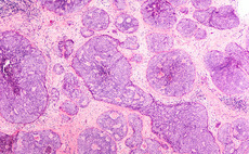 Redalpine backs CHF 6m funding round for Lunaphore