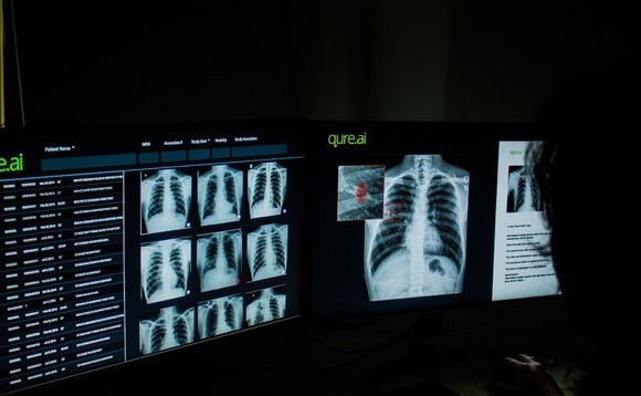 Sequoia, MassMutual back Indian medical imaging player