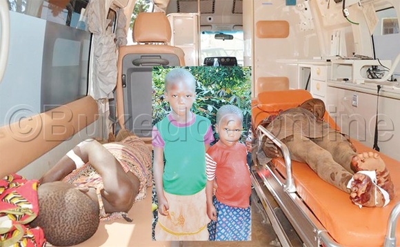 Abaana abaatomeddwa mmotoka nga batwalibwa mu ddwaaliro e Kawolo. Mu katono bwe babadde bafaanana. Abaana abaatomeddwa mmotoka nga batwalibwa mu ddwaaliro e Kawolo. Mu katono bwe babadde bafaanana.