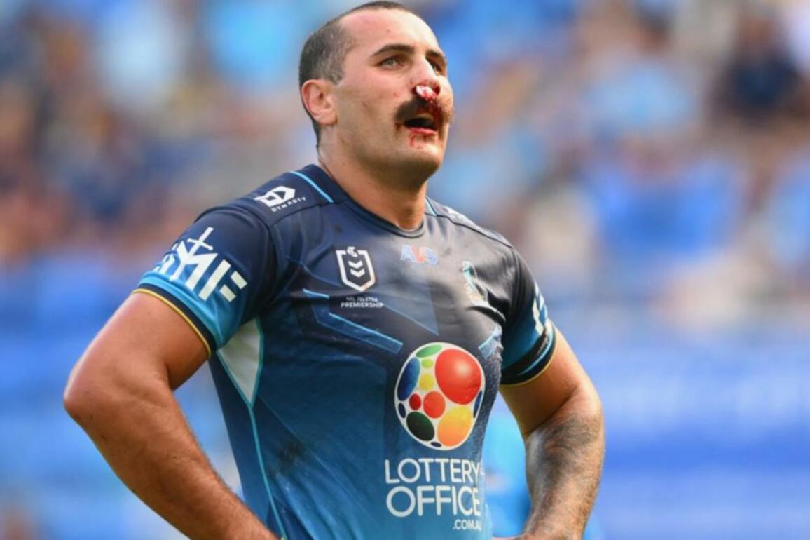 RCG 'nose' best as Titans aim to stop bleeding