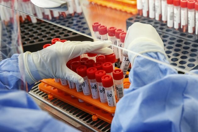 Chinese mainland reports 8 new confirmed COVID-19 cases