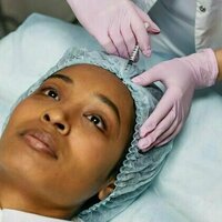 Thinking of getting botox or filler? These are the laws for cosmetic injectables