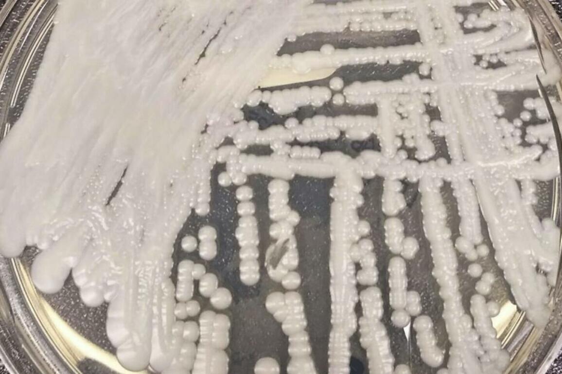 Drug-resistant fungus an 'urgent threat' as it spreads in hospitals