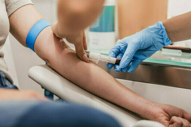 Every Dutch person has forever chemicals in their blood  study