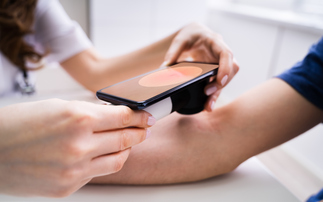 Healix launches skin cancer checks for employees