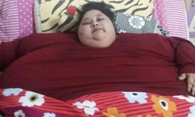 Indian doctors prepare 'world's heaviest woman' for surgery Indian doctors prepare 'world's heaviest woman' for surgery