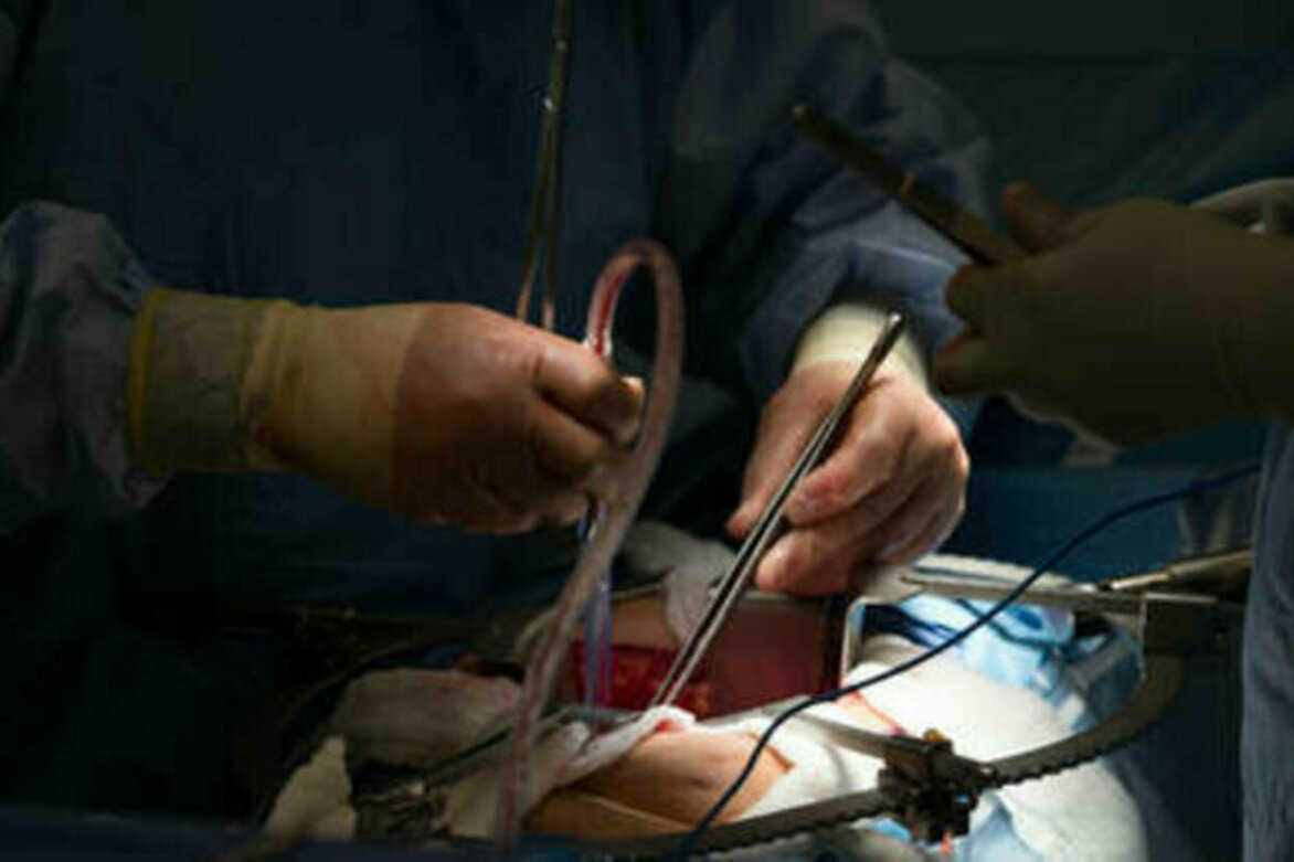 Switzerland changes organ donation rules