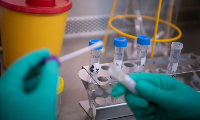 Zimbabwe reports first coronavirus case Zimbabwe reports first coronavirus case