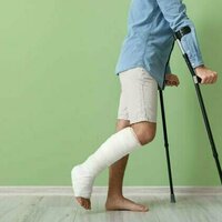 Why some people are purposefully having their legs broken by cosmetic surgeons