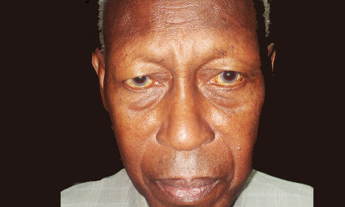Why is there confusion among presidential aspirants in Uganda? Why is there confusion among presidential aspirants in Uganda?